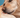 picture of a lab with a skin infection
